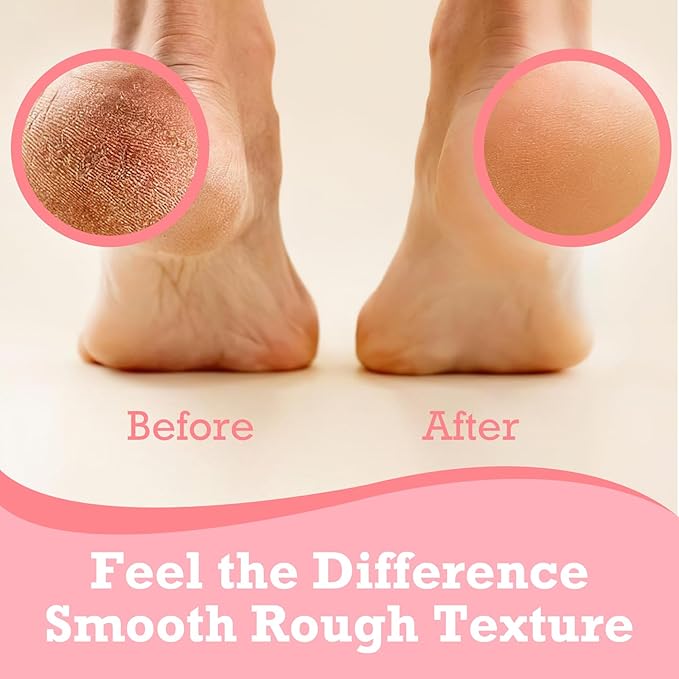 Foot Balm Stick Duo (2PC) | Hydrating & Moisturising Heel Balm | Softening and Nourishing Cream for Dry Heels, Hands & Elbows | Plant-Based Gentle Foot Cream (Pink & Blue)