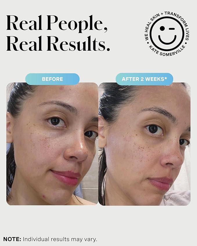 Kate Somerville EradiKate 3% Sulfur Daily Foaming Cleanser Acne Treatment – Clinically Formulated Medicated Face Wash Balances Skin & Cleans Pores, 4 Fl Oz