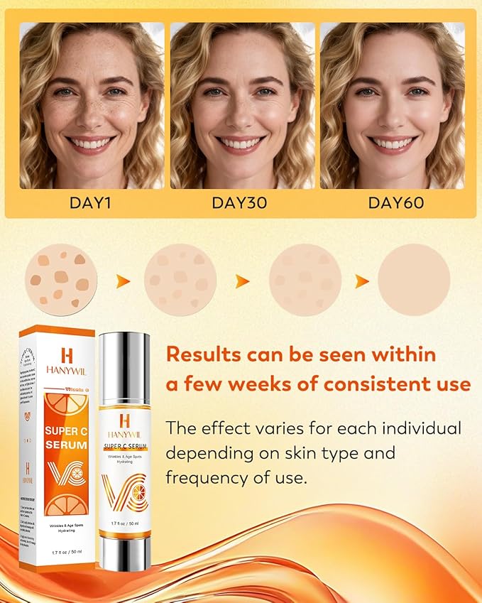 HANYWIL Vitamin C Serum for Mature Skin, 20% Vitamin C Face Serum with Hyaluronic Acid, Dark Spot Remover, Hydrating Skincare for Wrinkle Reduction, Lifting & Firming - 1.7 fl