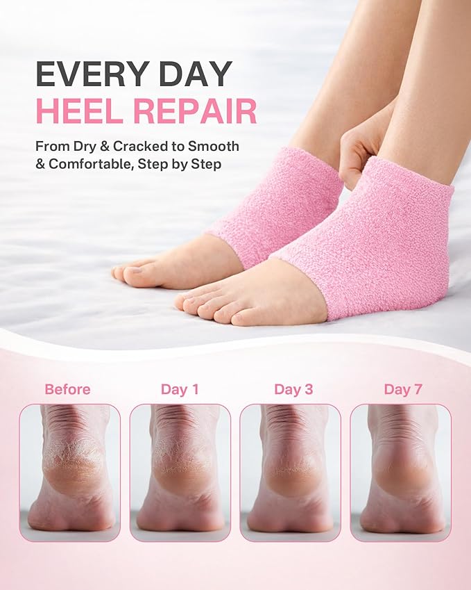 Moisturizing Socks Women, Feather Yarn Gel Socks, Foot Moisturizing Socks(Size 9-11) Deeply Hydrating for Dry, Cracked Heels, Silicone Socks for Women, Perfect Galentines Day Gifts, 1 Pair (Heel-Pink)