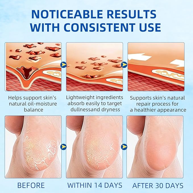 Urea Foot Cream 60% with Salicylic Acid 2%, Foot Care Stick for Cracked Heels, Callus Remover & Exfoliating Moisturizer for Dry Feet, Hands and Knees