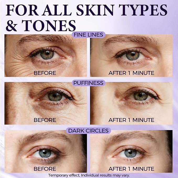 Tuggle Instant Eye & Face Tightening Serum, Instant Lift Eye Gel Cream Rapid Improve Under Eye Bags and Puffiness, Tightener Wrinkles & Fine Lines Fast, for Women & Men in Minutes, 0.67 oz