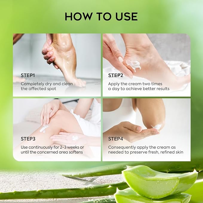 Urea Cream 42% Foot Cream Salicylic Acid 4 Oz, Upgraded Callus Remover For Feet, Knees& Elbows, Intensive Moisturizes & Softens Skin, Exfoliates Dead Skin
