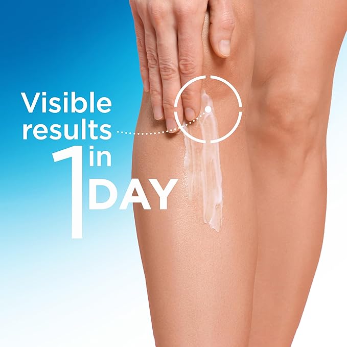 Flexitol Very Dry Skin Cream, Intensive Moisturizer for Severely Dry Skin, Urea-Based Hydration, 4 oz Tube