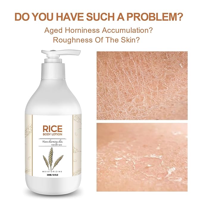 Grospe Rice Moisturizing Body Lotion for Women, Body Firming Moisturizer with Rice Extract for Dry Skin, Moisturizer Body Cream for Nourishing Non-Greasy Refreshing Quickly Absorbed 10.1 Fl Oz