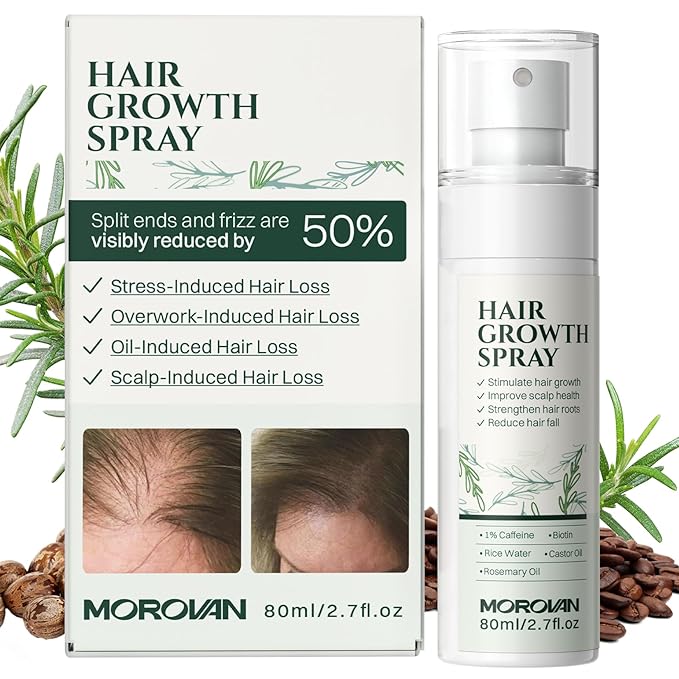 Morovan Hair Growth Spray for Scalp: 30 Days Hair Loss Reduction & Hair Growth with Batana and Castor Oil for Thinning Hair & Damaged Hair & Severe Hair Loss-2.7 fl oz