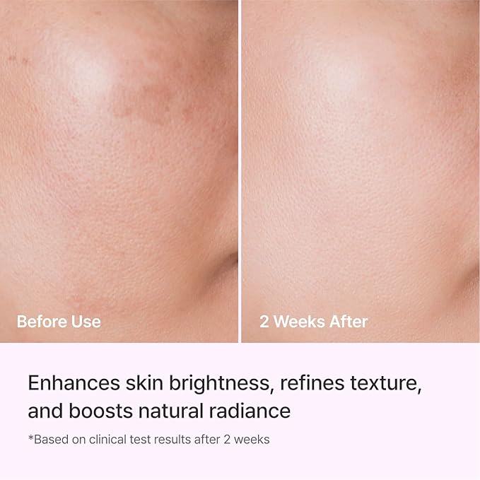 REJURAN® Triple Radiance Ampoule 50ml – DOT™ c-PDRN 0.5% Serum for Tone, Texture & Glow – Niacinamide & Licorice Extract for Even-Looking Skin