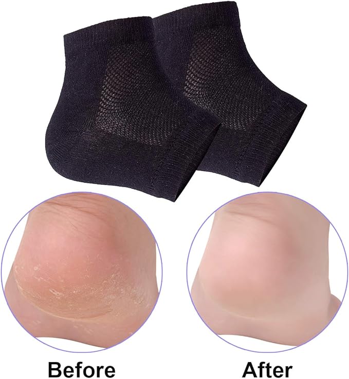 Vented Moisturizing Gel Heel Socks, 3 Pairs Toeless Spa Sock for Foot Care Treatment, Cracked Heels, Dry Feet, Foot Calluses (Black)