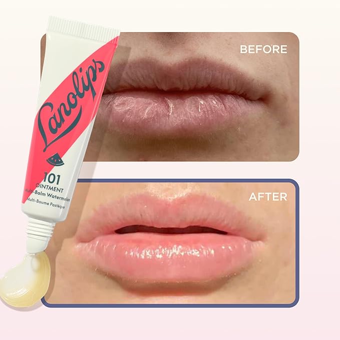 Lanolin 101 Multipurpose Ointment - Lanolin Lip Balm & Healing Ointment for Skin Barrier Repair - Moisturizer for Dry Lips, Cuticles & Elbows - No Petroleum Formula - Watermelon (0.35 oz)