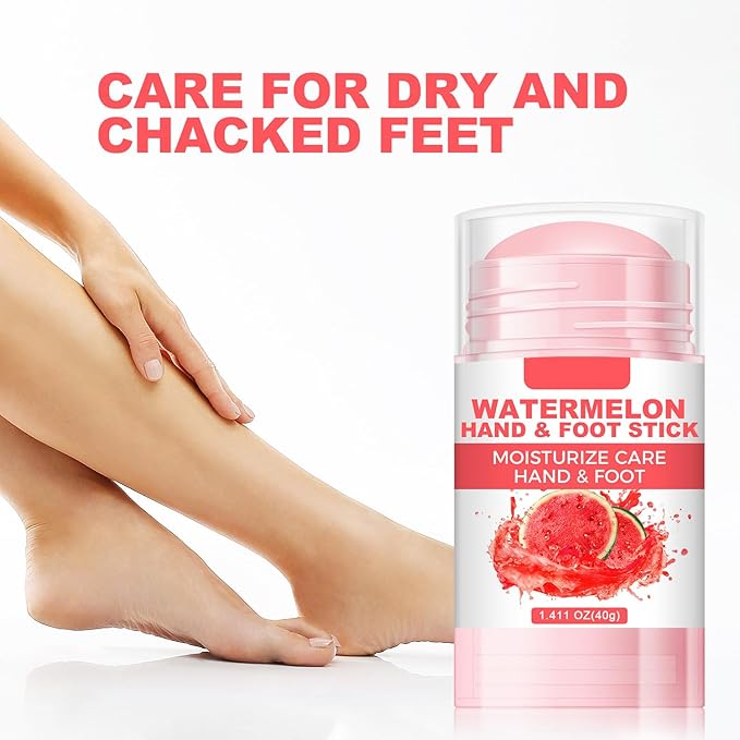 60% Urea Cream Foot Hand Cream Stick for Cracked Hands Elbows Feet Knees, Repairing Restore Balm for Dry & Dead Skin, Hydrates & Nourish Foot Care for Women & Men (Watermelon, 1.41 oz)