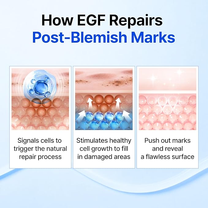 DearKlairs Korean EGF Serum - Blue Youth Activating Drop with EGF & FGF (10ppm Each), Barrier Repair & Post-Blemish Marks, Sensitive Skin-Friendly, Daily Calm & Repair, 0.67 Fl Oz
