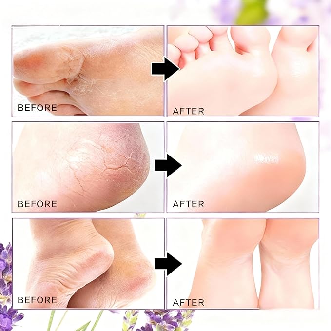Foot Masks for Dry Cracked Feet, Lavender Moisturizing Socks - Intensive Hydrating Foot Care & Cracked Heel Treatment, 3 Pairs