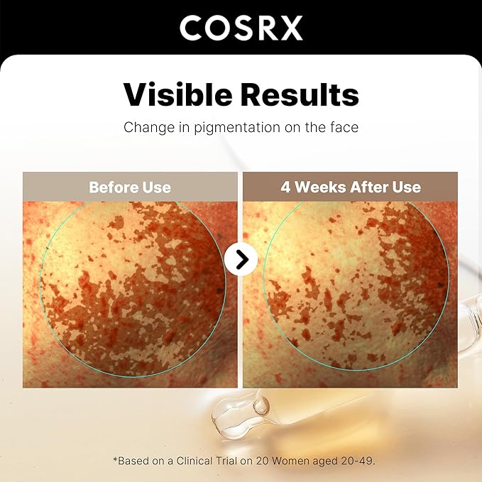 COSRX 2% Alpha Arbutin Discoloration Care Face Serum with Niacinamide, Glutathione & Tranexamic Acid, Serum to Target Dark Spots and Hyperpigmentation, Daily Korean Skin Care, 1.7 fl oz