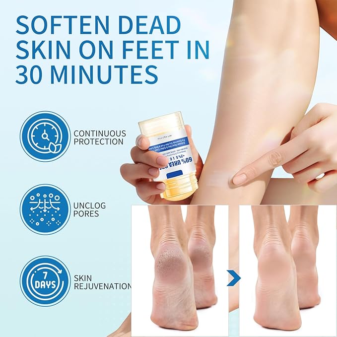 60% Urea Foot Cream Stick - Foot Care Balm Moisturizer for Dry Cracked Feet Hands Knees Elbows Hands Maximum Strength - 2Pcs Moisturizing Heel Balm Hydrates Calluses Remover Rough Skin Softener 1.41oz