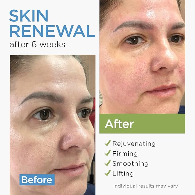 Moisturizer Collagen Anti-Aging Face Cream with Stem Cells, Retinol, Hyaluronic Acid & Niacinamide - Hydrating Day & Night Wrinkle Cream for All Skin Types - Airless Pump - Made in USA - 1.7Oz