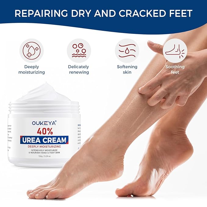 OUKEYA Urea Cream 40 Percent for Feet, Maximum Strength Moisturizer, Intensive Hydrating Foot Cream for Dry Cracked Skin, Softens Rough Heels, Knees & Elbows, 5.29 oz