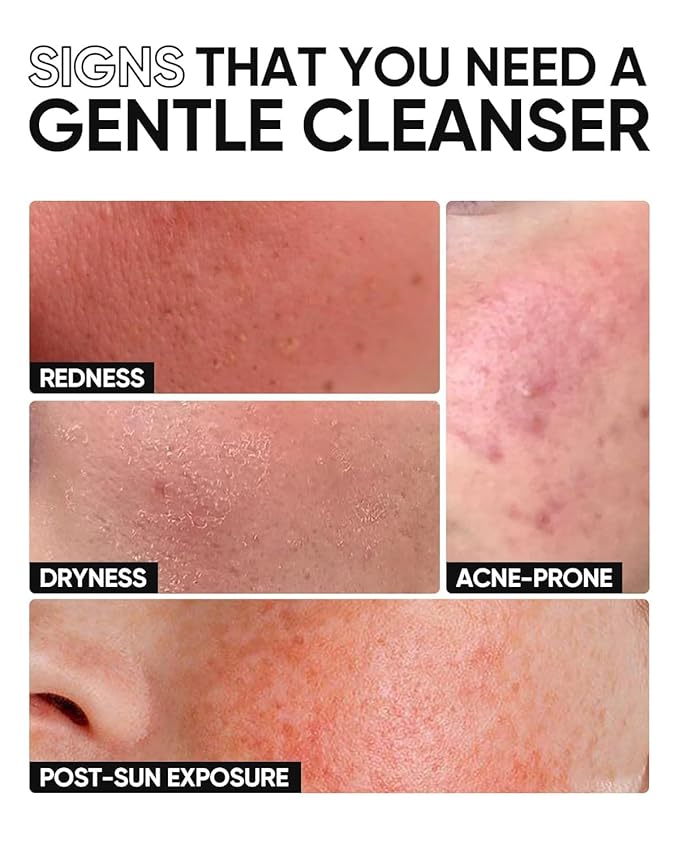 SKINTIFIC 5X Ceramide Low pH Facial Cleanser, Gentle Hydrating Face Wash with Hyaluronic Acid, Daily Face Wash for Dry to Normal Skin, Sensitive Skin Tested, Not Tight, Fragrance Free,120ml