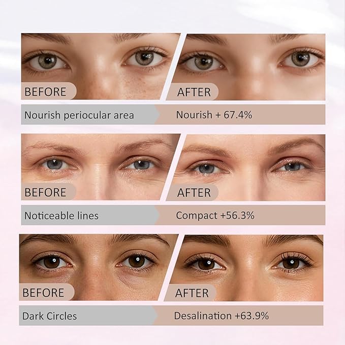 Collagen Eye Mask, 2026 New 7 PCS Peptide-Powered Deep Collagen Eye Mask, Under Eye Patches 360° Fit, Eye Mask with Collagen Peptide, Eye Patches for Puffy Eyes and Dark Circles