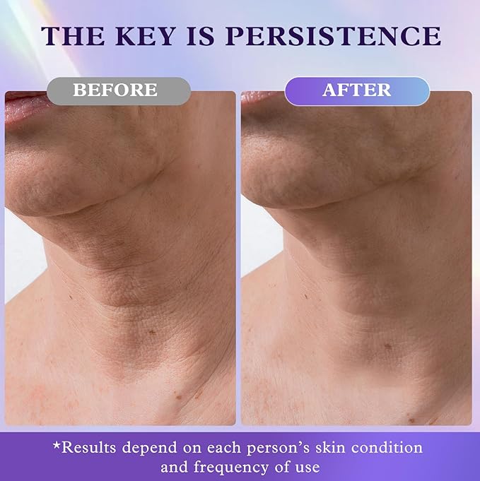 UKVOA Retinol Neck & Face Wrinkle Cream for Women, Neck Cream for Tightening and Firming, Anti Aging Skin Care with Collagen & Hyaluronic Acid, Instant Face Lift Cream 2-Pack