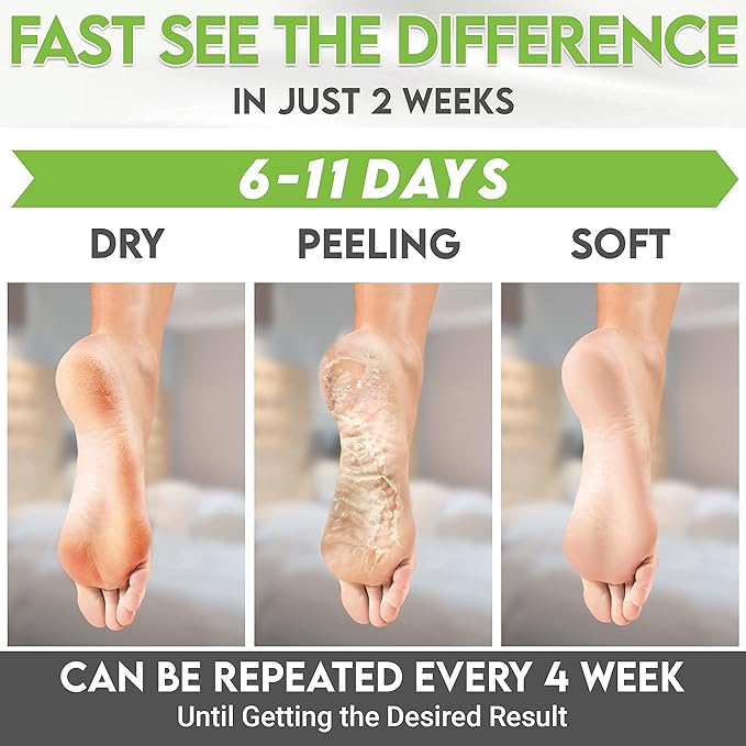 Foot Peel Mask Green Tea Moisturizing Exfoliating Foot Masks - Karma Organic Feet Peeling Masks for Dry ed Feet, Remove Dead Skin & Calluses - Removes & Repairs Rough Heels, Dry Toe Skin (Pack of 2)