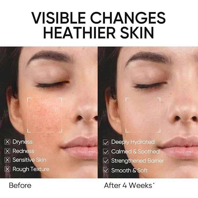Face Moisturizer with 5X Ceramides, Hydrating Moisture Barrier Repair Cream for Sensitive/Oil Skin Types, Hyaluronic Acid & Centella, Daily Facial Moisturizer, Non-Comedogenic 50g/1.76 OZ