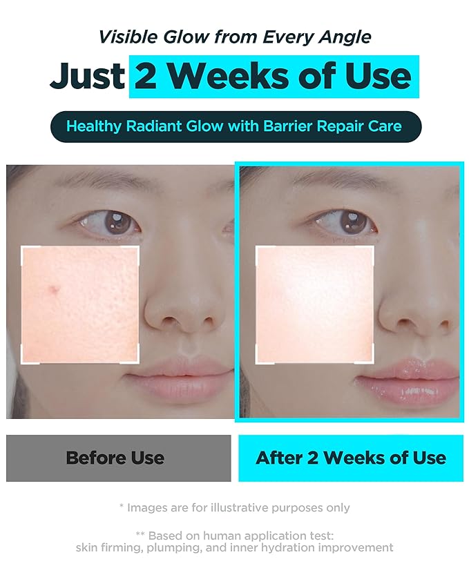 WELLAGE Korean Hyper PDRN Repair Anti-Aging Serum Ampoule - Hyaluronic Acid, Collagen Elasticity Pore Care with Sodium DNA, Beta-Glucan and Panthenol, 1.01 fl.oz