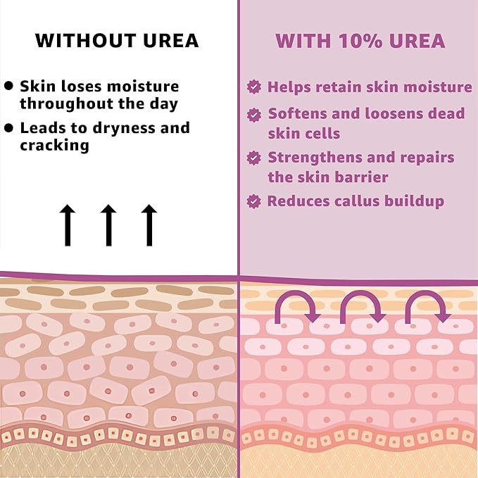 10% Urea Cream with Aloe Vera, Jojoba Oil and Salicylic Acid - 150ml Hydrating Moisturizer for Dry, Chapped Hands, Feet, Face & Body - Repairs, Soothes & Nourishes Rough, Dry Skin - 4 Oz