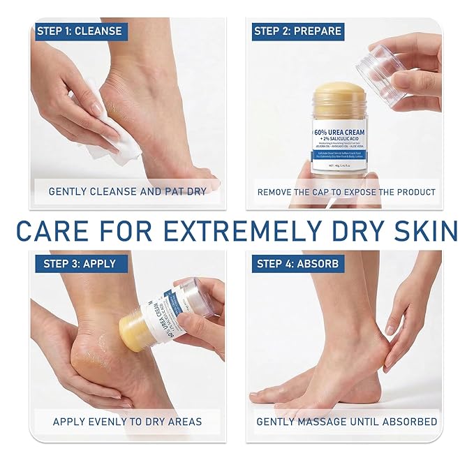 2Pcs Urea Cream 60% plus 2% Salicylic Acid Urea Foot Cream Stick,Foot Cream for Dry Cracked Heels and Feet,Hands,Elbows,Knees,Exfoliating Moisturizer,Soften Dead Skin Foot Balm,1.41 Oz