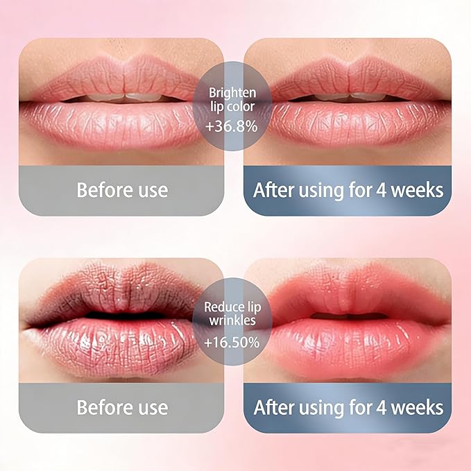 Red Light Therapy Lip Plumping Device, Lip Plumper Tool for Face with Whitening Mouthpiece