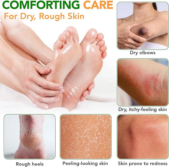 ABOUME Tea Tree Oil Balm, Tea Tree Balm Help Dry, Itchy & Fungal-Prone Skin, Soothing Moisturizing Balm Suitable for Feet, Heels, Hands & Body, Natural Formula, 60g (1PCS)