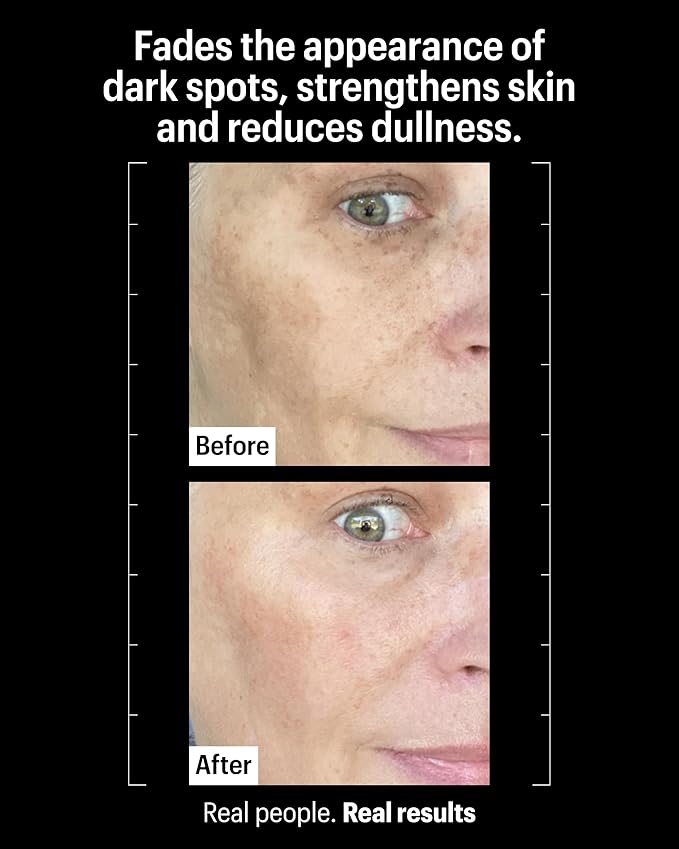Allies of Skin Tranexamic & Arbutin Advanced Brightening Serum | Lightweight Daily Serum with Peptides | 3% Tranexamic Acid, Helps Revive Tired Complexions | 1.6 fl oz