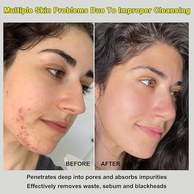 SEWOG Recovery Mud Mask, Relief Mud Mask for Face & Body, Deep Cleansing & Hydrating Clay Mask, Deep Pore Cleanser Oil Control Wash Off Body Mud