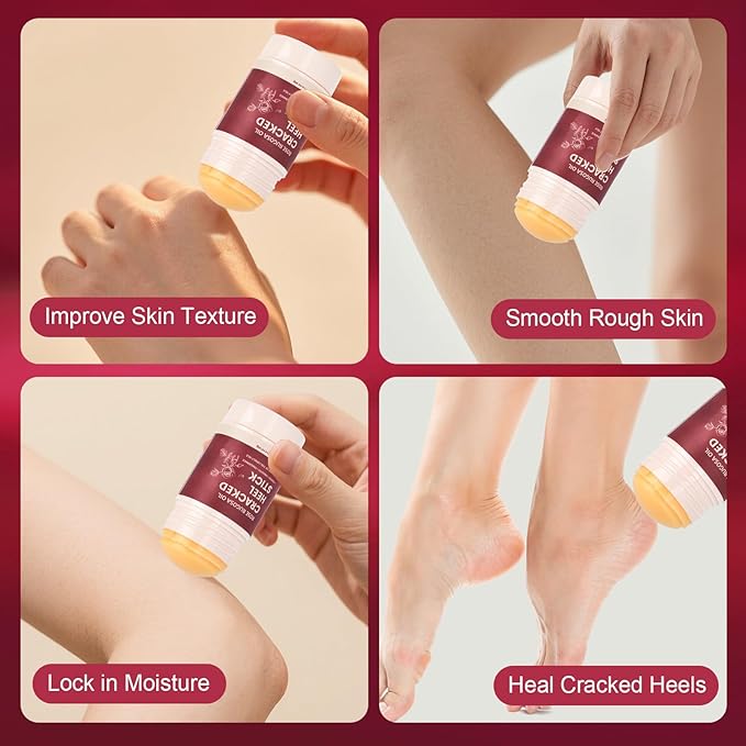 TEAWOO 5Pcs Cracked Heel Treatment & Repair Stick – Rose Oil Infused cracked heel stick Balm for Dry, Cracked Heels – No-Mess Applicator, Travel-Friendly