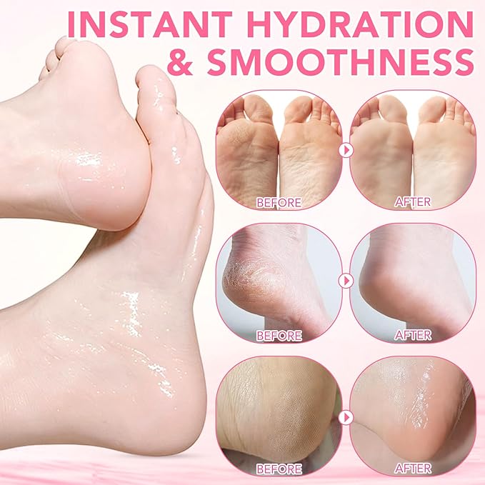 60% Urea plus 2% Salicylic Acid Foot Care Stick, Deep Hydration Soften & Smooth Thickened Areas, Intensive Moisturizer Repairs for Dry, Cracked Heels & Thickened Skin (1.41 Ounce, Peach)