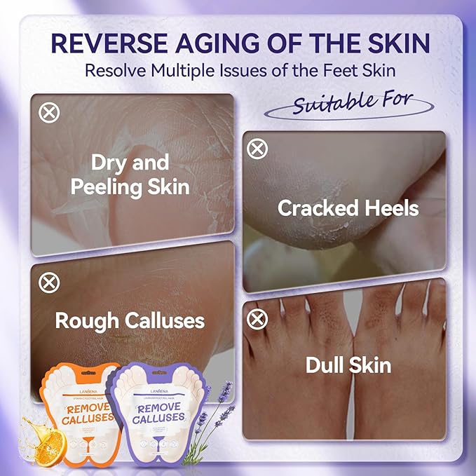LANBENA Lavender + Vitamin C Foot Peel Mask（2 Pairs, Exfoliator Peel Off Calluses Dead Skin Callus Remover, Repairing Rough Heels for Men and Women, for Baby Soft & Smooth Feet