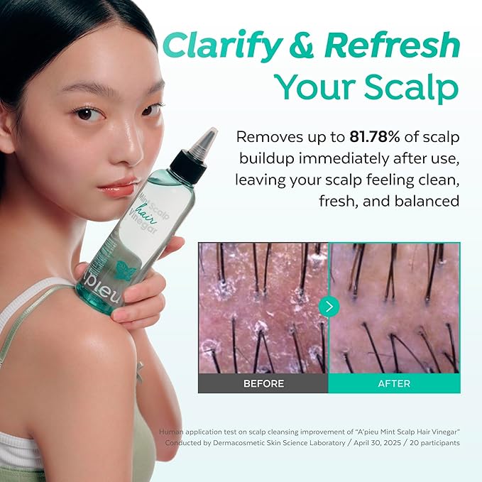 A’PIEU Mint Hair Vinegar Rinse for Cooling & Clarifying Scalp Care, Detox & Refreshing Treatment, Dandruff & Buildup Removal, Fresh Mint Scent, pH Balancing, Korean Haircare, 6.76 fl oz