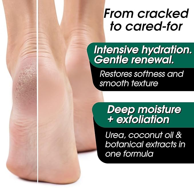 Urea 40% Cream for Feet Maximum Strength – Intensive Foot Repair & Cracked Heel Treatment – Athletes Foot Treatment Peel Mask – 40% Lotion for Dry Skin & Hand Cream for Women & Men – 4 Fl Oz