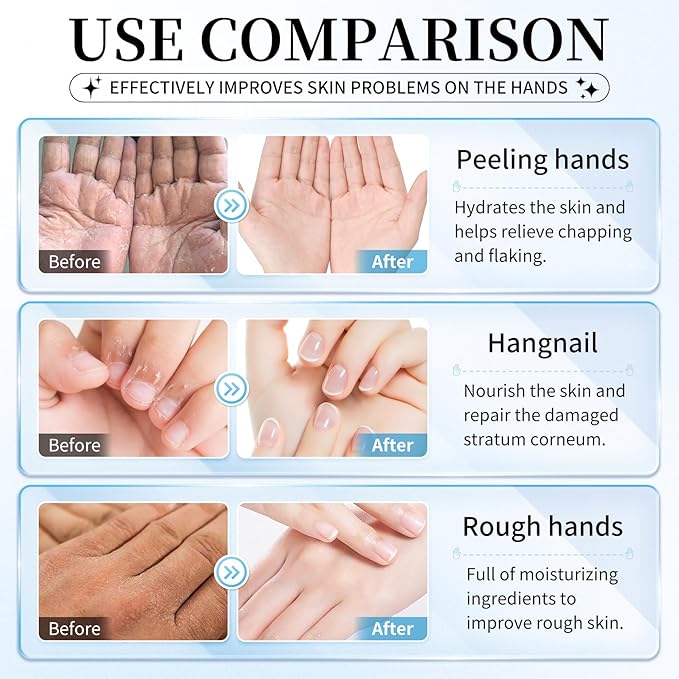 AIUEO 10 PCS Hand Mask Moisturizing Gloves, Hydrating Hand Masks for Dry Cracked Hands, Exfoliating Hand Peeling Mask, Nourishing Collagen Gloves for Hands