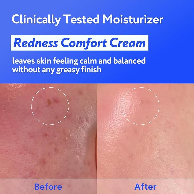 Coconut Hydro Barrier Cream | Soothing & Barrier Repair Moisturizer with Panthenol, Ceramide & Squalane | Non-Greasy, Fragrance Free Capsule Cream Korean Skin Care (80ml / 2.7 fl oz)