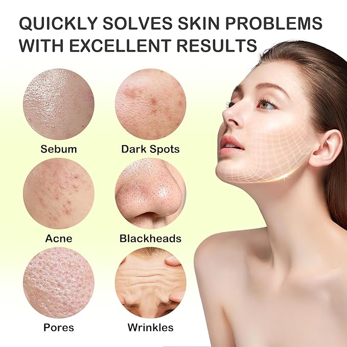24 Pcs Clay Face Mask with Brush,Hydrating Mud Face Mask Set,Deep Cleaning Oil Control Clay Facial Masks for Blackheads Remover,Mud Facial Masks Skincare Gift Set