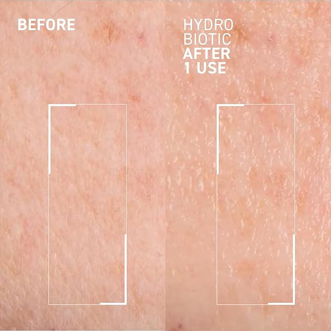 Dr. Brandt Hydro Biotic - Recovery Sleeping Mask - Deeply Hydrates + Reduces Redness & Signs of Irritation - 1.7 oz