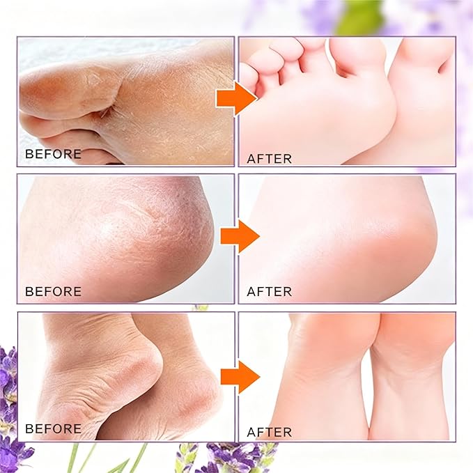 Peeling Foot Mask 3 Pack | Lavender Extract Foot Peel for Dead Skin Removal & Heel Repair | Dermatologically Tested