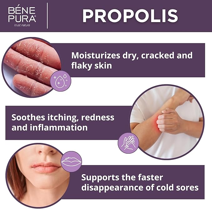 BenePura Propolis Ointment - Natural Anti Itch Cream with 30% Propolis - Itch Relief for Humans, Rash Cream - Multipurpose Moisturizing Propolis Cream for Dry Skin and Cracked Heel Repair - 1.35fl. Oz