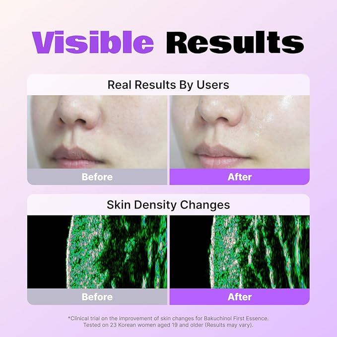 LALARECIPE Bakuchinol First Essence, Bakuchiol + Retinol Milky Toner with Peptides & Niacinamide, Fine Lines, Texture & Dark Spot Care, Korean Skincare for All Skin Types (5.24 Fl Oz / 155ml)