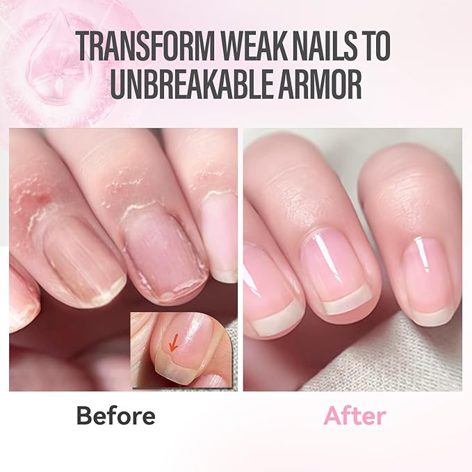 CHUCHU Vegan Cuticle Oil for Nails: Peach Jojoba Nail Cuticle Oil with Vitamin B & E for Moisturizes Cuticle and Nail's Skin - Prevents Hangnails and Chapped 15ML