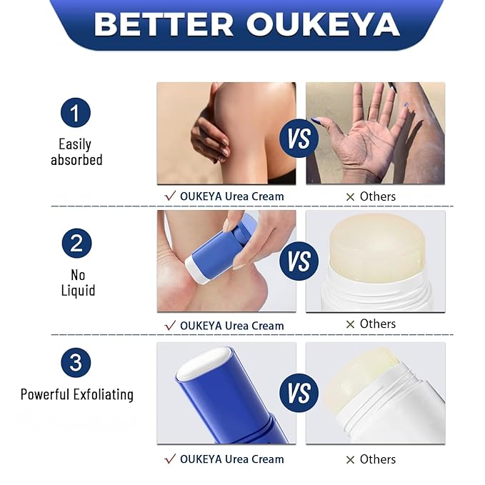 OUKEYA Urea Cream Stick 60% with 2% Salicylic Acid | Intensive Urea Foot Cream to Soften Extremely Dry, Cracked Heels & Rough Skin, 0.7oz