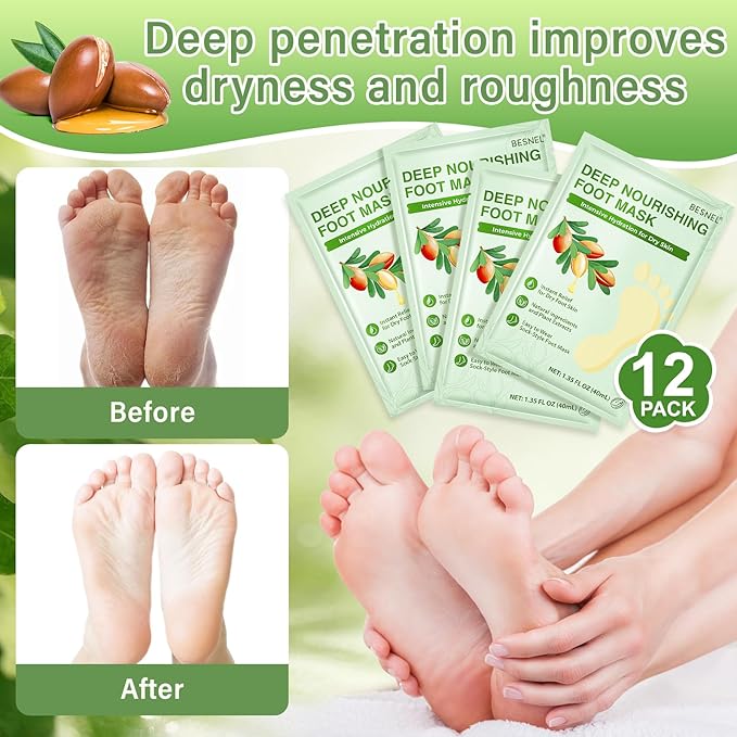 BESNEL 12Pack Moisturizing＆8Pack Foot Peeling Foot Mask, Teacher Appreciation Gifts, Hydrating Foot Masks Dry Cracked Feet,Soothing Moisturizer Socks Repair Rough Heels＆Baby Soft Feet(20p)