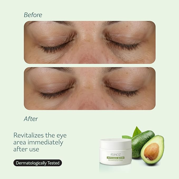sinoz Hydrating Eye Cream with Avocado Oil, Caffeine & Peptides, 15 ml - Avocado Eye Cream, Dark Circles Eye Cream for Puffiness & Dry Under Eyes, Day and Night Skincare for Women