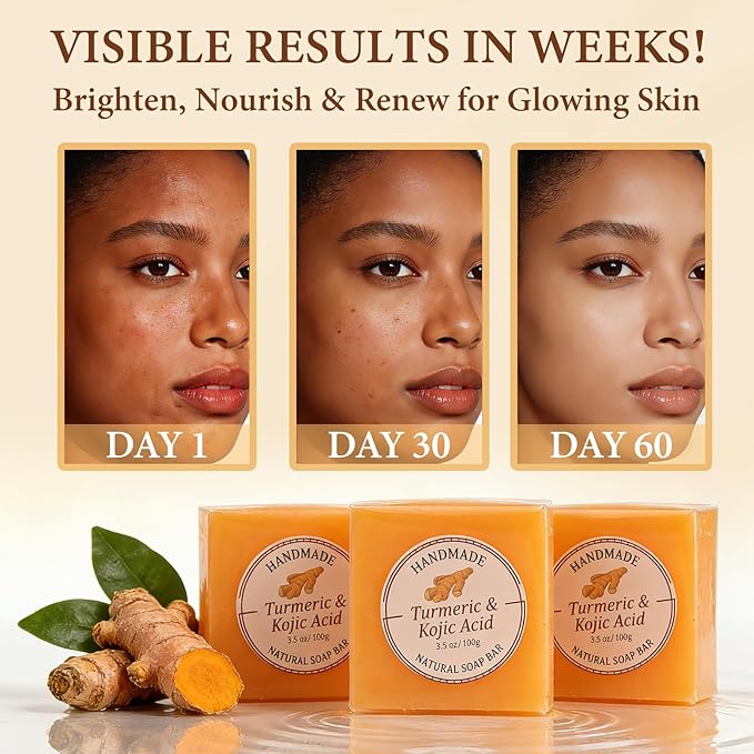 Kojic Acid Soap, Turmeric Soap Bar for Dark Spots, Brightening Face & Body Wash with Vitamin C, Tea Tree Oil & Shea Butter, Acne Scars, Hyperpigmentation & Even Skin Tone, 3 Pack