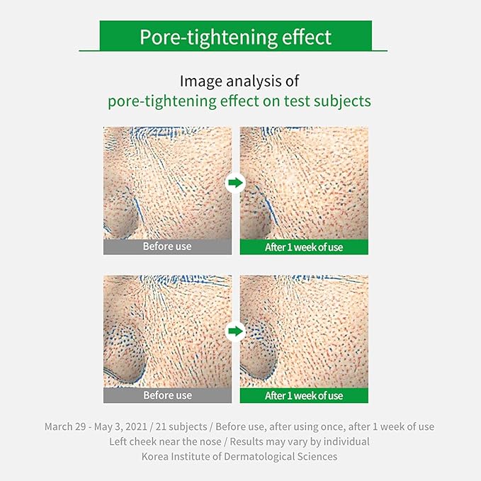 Real Cica Calming Zero Pore Toner Pads 70 Sheets Big Embo, Korean Beauty Facial Pads, Centella Asiatica, PHA, LHA, and Madecassoside, for Pore Tightening, Moisturizing, Hypoallergenic